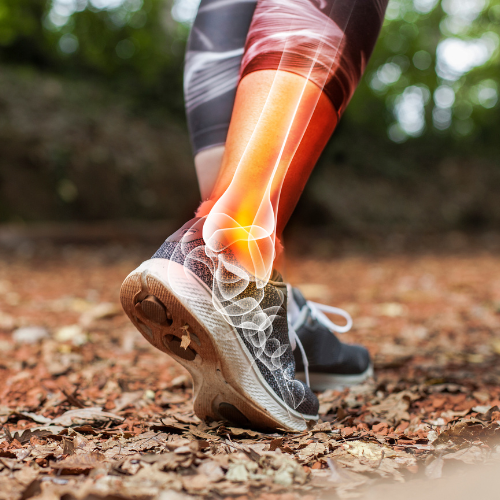 a picture of an ankle that is inflamed due to muscle pain.